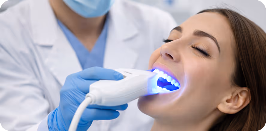 Procedura de albire dentara realizata intr-un cabinet stomatologic